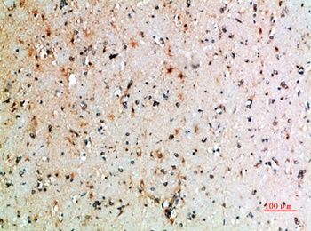 CTLA4 antibody