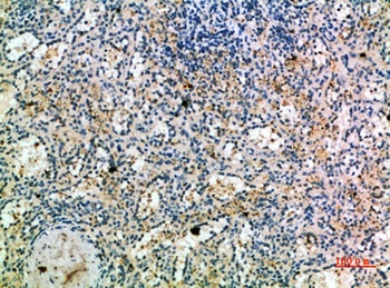 CKR-1 rabbit pAb