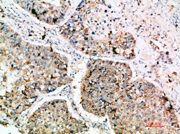 DC-LAMP rabbit pAb Antibody