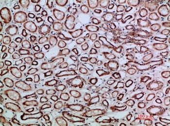 TGFbeta2 antibody