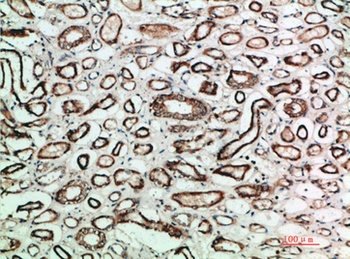 TGFbeta2 antibody