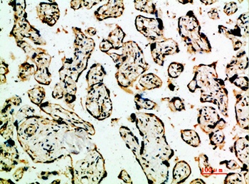 TGFbeta2 antibody