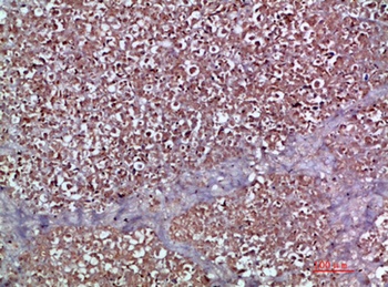 MIP-3alpha antibody