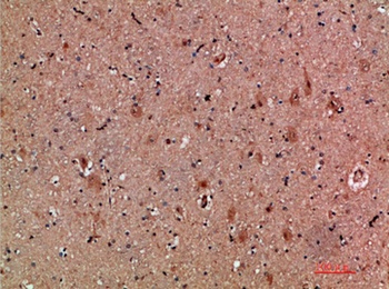 NNT-1 rabbit pAb