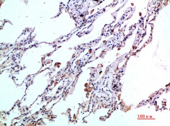 Eotaxin-2 rabbit pAb
