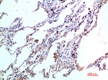 Eotaxin-2 antibody