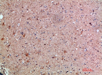 PBP antibody