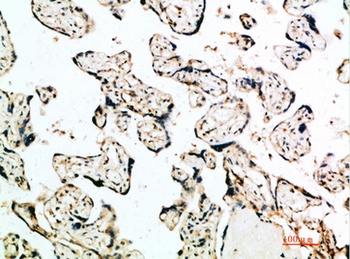 IFN-β rabbit pAb Antibody
