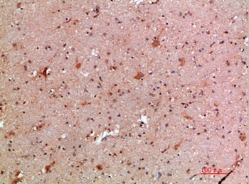 IFN-β rabbit pAb Antibody