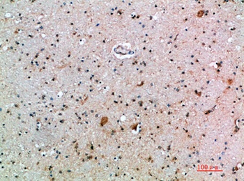 IFN-β rabbit pAb Antibody
