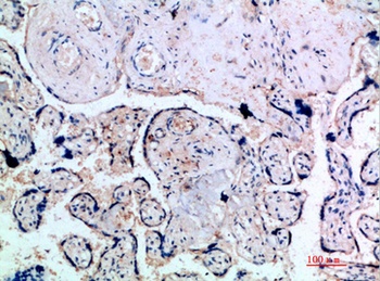 Inhibin α rabbit pAb