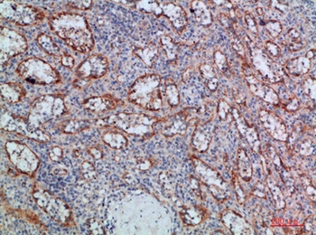 LT-β rabbit pAb