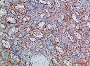 LT-beta antibody