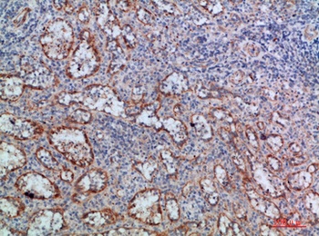 LT-beta antibody