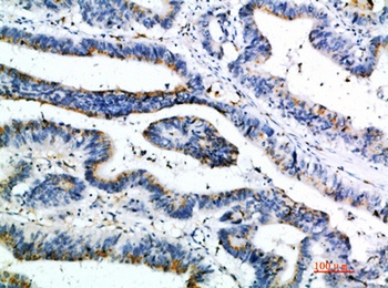 6CKine antibody