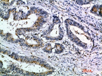 6CKine antibody