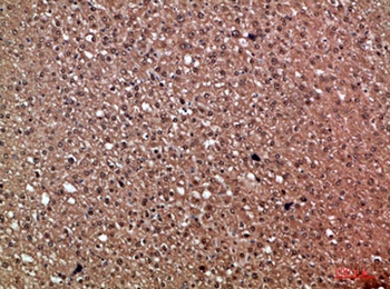 HDGF antibody