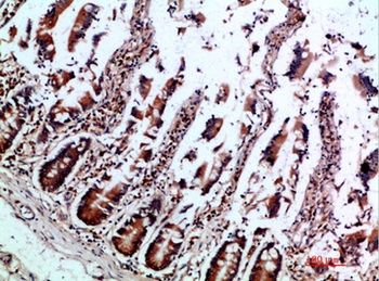 IL12B p40 antibody