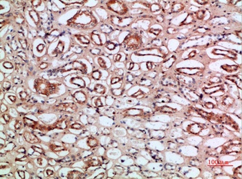 Tetranectin rabbit pAb Antibody