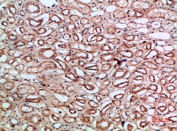 Tetranectin rabbit pAb Antibody