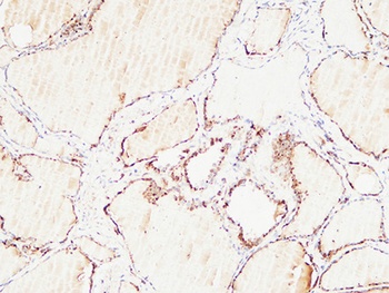 Thyroglobulin antibody