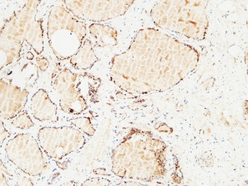 Thyroglobulin antibody