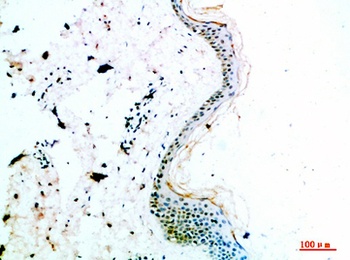 COL14A1 rabbit pAb
