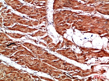 TTN antibody