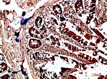 HLA-DQA1 antibody