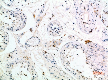 PMCH rabbit pAb