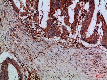 Cystatin B rabbit pAb