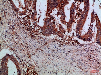 Cystatin B antibody