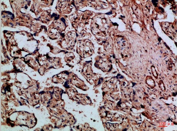 Cystatin B rabbit pAb