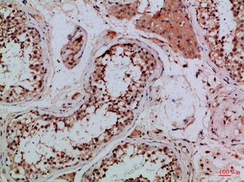 Tubulin γ rabbit pAb