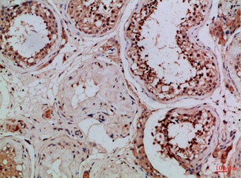 Tubulin γ rabbit pAb