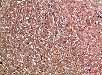Haptoglobin rabbit pAb