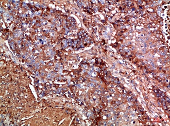 Haptoglobin rabbit pAb