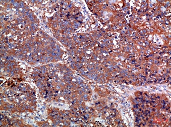 Haptoglobin rabbit pAb