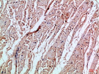 MIA rabbit pAb Antibody