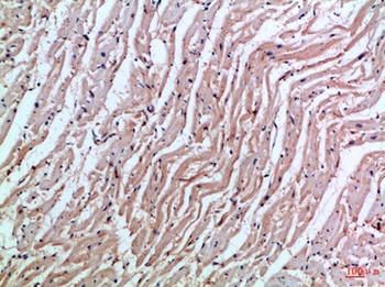 MIA rabbit pAb Antibody