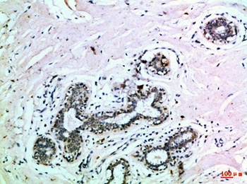 EphB3 rabbit pAb Antibody