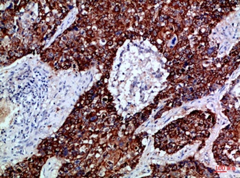 EphB3 rabbit pAb Antibody