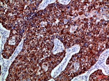 EphB3 rabbit pAb Antibody