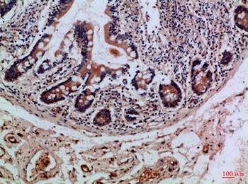 Integrin αE rabbit pAb
