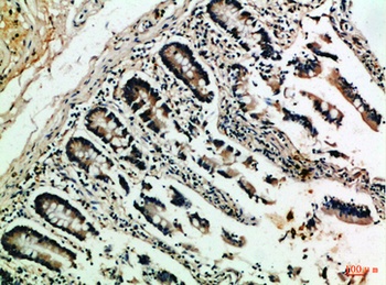 NFATc2 rabbit pAb Antibody