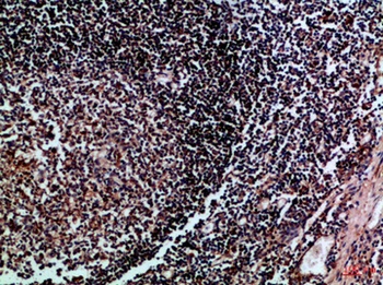 HLA-DMβ rabbit pAb Antibody