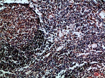 HLA-DMβ rabbit pAb Antibody