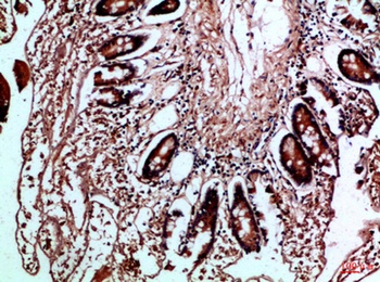 HLA-DMβ rabbit pAb Antibody
