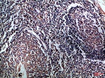 CD1A/B rabbit pAb