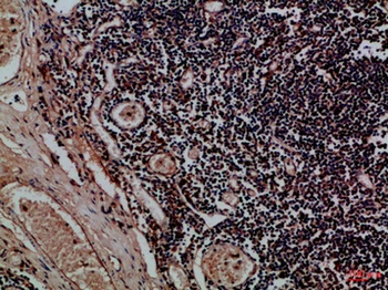 CD158f1/2 rabbit pAb Antibody